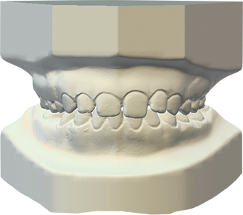 DWOS CAO / FAO - Archivage orthodontique - Dental Wings DWOS CAO / FAO - Archivage orthodontique - Dental Wings