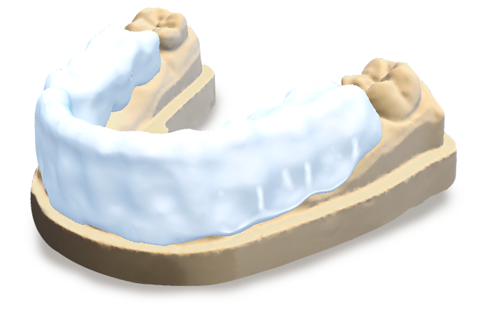 DWOS CAO / FAO - Plaques occlusales - Dental Wings DWOS CAO / FAO - Plaques occlusales - Dental Wings