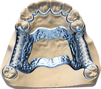 DWOS CAO / FAO - Prothèses partielles - Dental Wings DWOS CAO / FAO - Prothèses partielles - Dental Wings