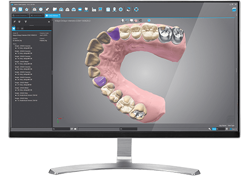 cad cam for dental lab