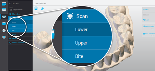 Intuitive Scanner Interface - Virtuo Vivo™ - Dental Wings Intuitive Scanner Interface - Virtuo Vivo™ - Dental Wings