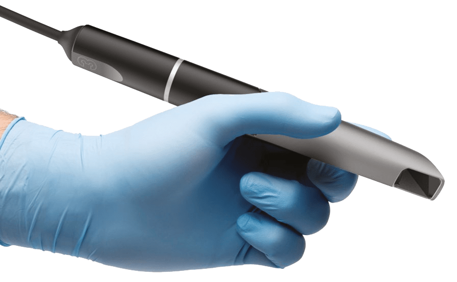 Virtuo Vivo™ Scanneur Intraoral - Dental Wings Virtuo Vivo™ Scanneur Intraoral - Dental Wings