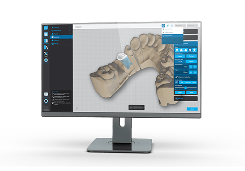 TRANSFER the scan file directly via DWOS Connect for the design of the restoration with DWOS Chairside.