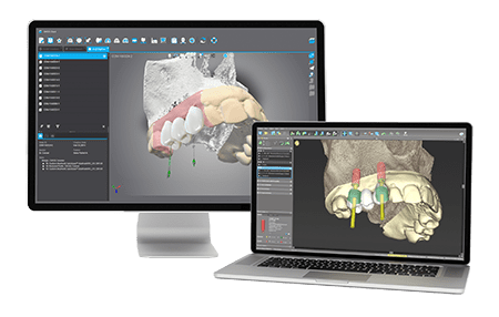 DWOS Synergy - Dental Wings DWOS Synergy - Dental Wings