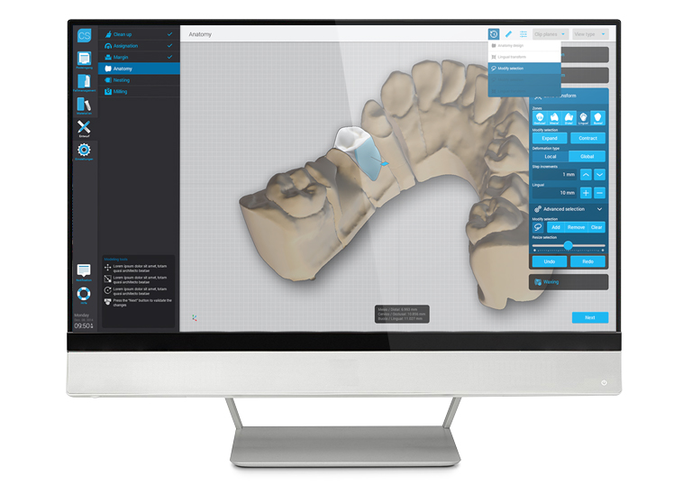 DWOS Chairside est un logiciel de conception ouvert. DWOS Chairside est un logiciel de conception ouvert.
