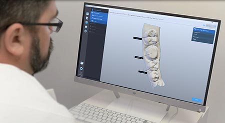 DWOS Chairside - Conception - Dental Wings