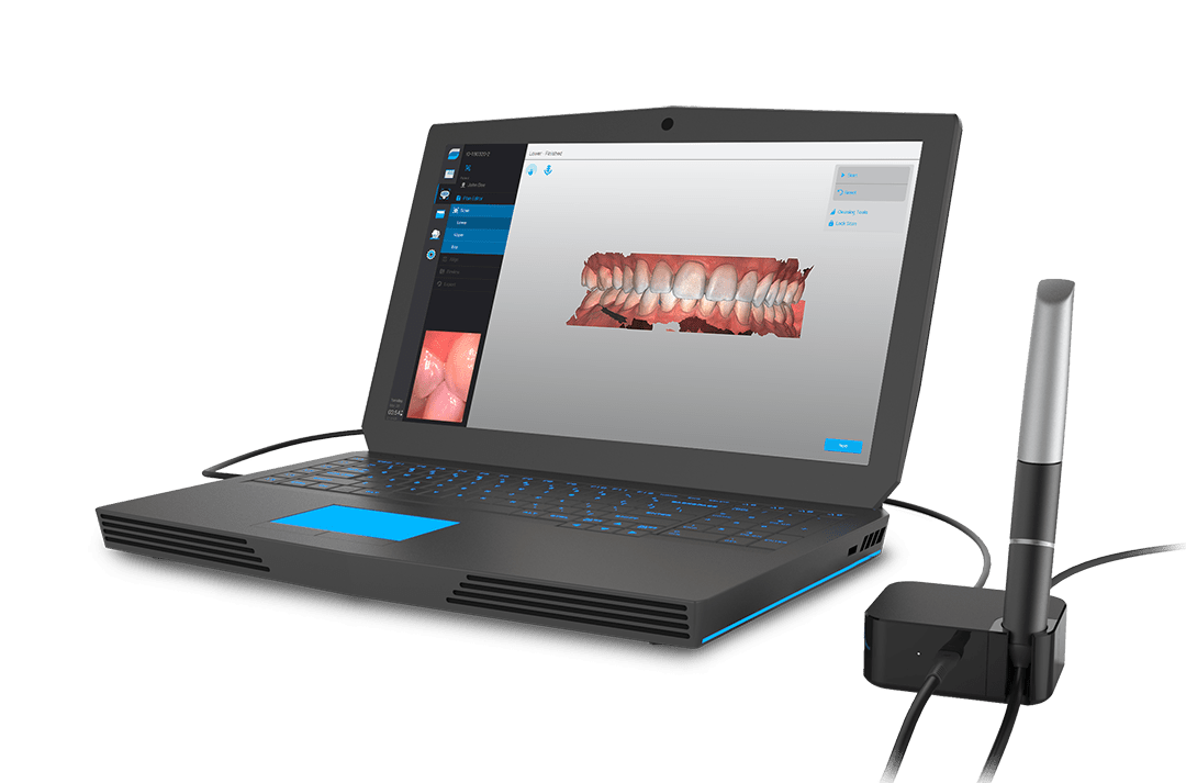 DWOS Chairsidele scanneur intraoral Virtuo Vivo™ Dental Wings