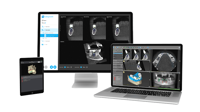 CDX Easy. Una soluzione digitale potente e facile da usare - Dental Wings CDX Easy. Una soluzione digitale potente e facile da usare - Dental Wings