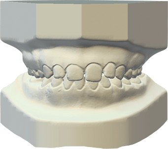 DWOS Archiviazione ortodontica - Dental Wings DWOS Archiviazione ortodontica - Dental Wings
