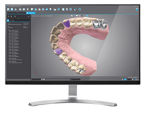 DWOS CAD/CAM - Dental Wings DWOS CAD/CAM - Dental Wings