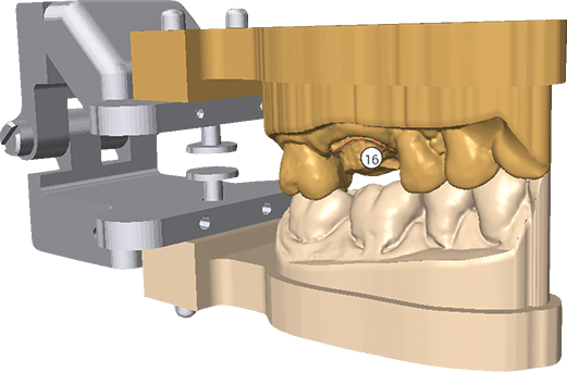DWOS Model Builder - Dental Wings DWOS Model Builder - Dental Wings
