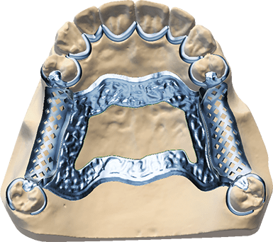 DWOS Protesi parziale - Dental Wings DWOS Protesi parziale - Dental Wings