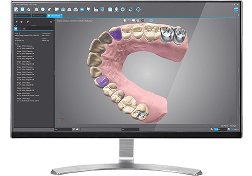 PROGETTA il wax-up in DWOS CAD/CAM