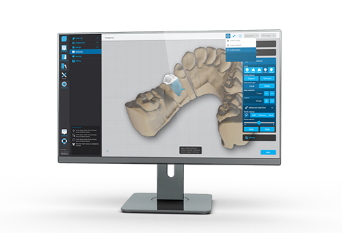 TRASFERISCI il file di scansione direttamente tramite DWOS Connect per la progettazione con DWOS Chairside