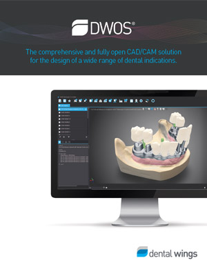 TRANSFER the scan file directly via DWOS Connect. DIGITAL WORKFLOWS FOR DENTAL CLINICS
