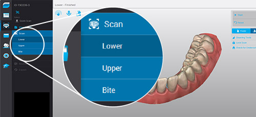 Interface de scanneur intuitive - Scanneur intraoral Virtuo Vivo™ - Dental Wings Interface de scanneur intuitive - Scanneur intraoral Virtuo Vivo™ - Dental Wings