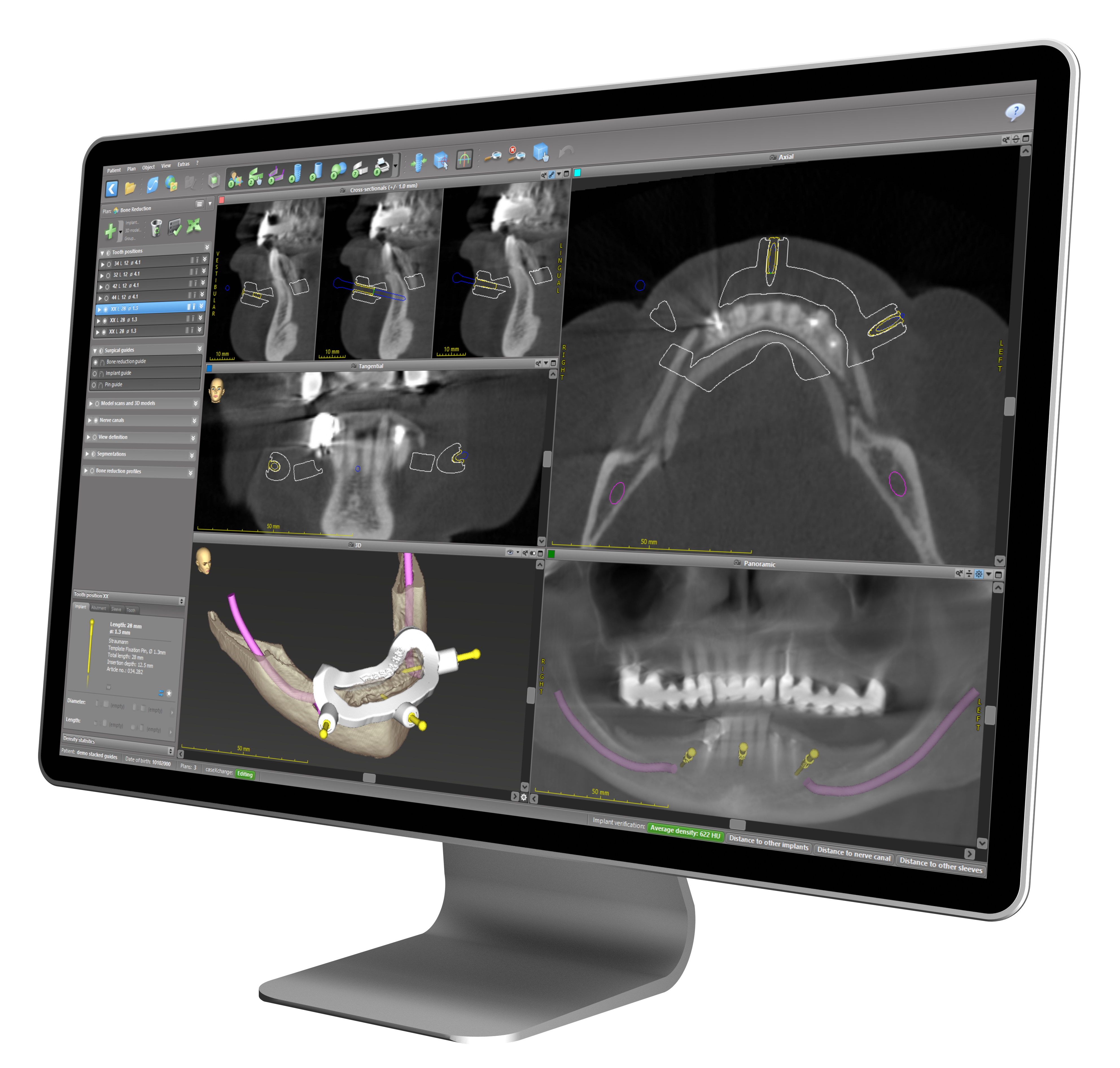 coDiagnostix - easy-to-use digital solution - Dental Wings